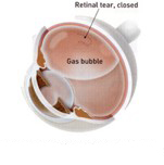 gas_bubble2